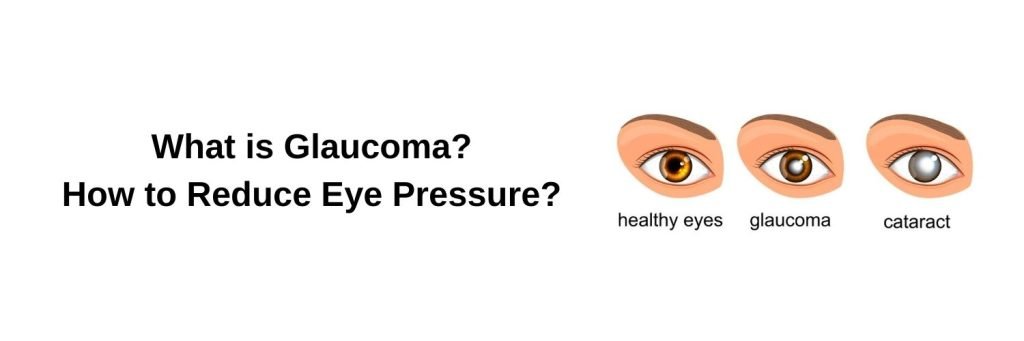 What is Glaucoma